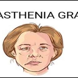 Nursing management of myasthenia gravis