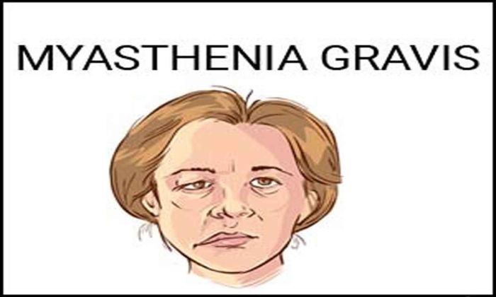 Nursing management of myasthenia gravis